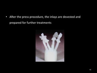 • After the press procedure, the inlays are devested and
prepared for further treatments
41
 