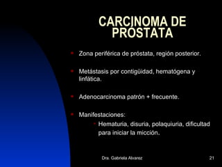 CARCINOMA DE PRÓSTATA Zona periférica de próstata, región posterior. Metástasis por contigüidad, hematógena y linfática. Adenocarcinoma patrón + frecuente. Manifestaciones: Hematuria, disuria, polaquiuria, dificultad para iniciar la micción . 