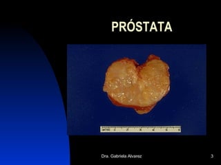 PRÓSTATA 