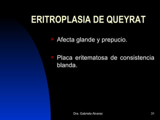 ERITROPLASIA DE QUEYRAT Afecta glande y prepucio. Placa eritematosa de consistencia blanda. 