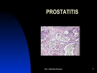 PROSTATITIS 