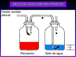 SELLO DE AGUA CON DOS FRASCOS
 