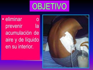 • eliminar o
prevenir la
acumulación de
aire y de líquido
en su interior.
 