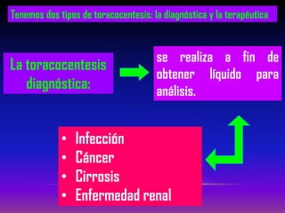 Tenemos dos tipos de toracocentesis: la diagnóstica y la terapéutica
La toracocentesis
diagnóstica:
se realiza a fin de
obtener líquido para
análisis.
• Infección
• Cáncer
• Cirrosis
• Enfermedad renal
 