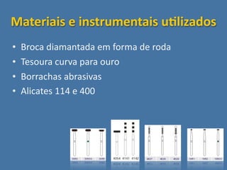 Materiais e instrumentais uSlizados
•   Broca diamantada em forma de roda
•   Tesoura curva para ouro
•   Borrachas abrasivas
•   Alicates 114 e 400
 