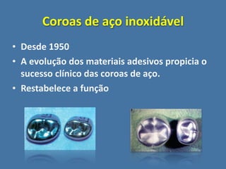 Coroas de aço inoxidável
• Desde 1950
• A evolução dos materiais adesivos propicia o 
  sucesso clínico das coroas de aço.
• Restabelece a função
 
