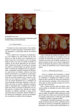 NÚCLEOS




                                                       FIG 5.81

■ FIGURAS 5.8H e 5.81
A cimentação é realizada introduzindo inicialmente a parte
fundida e depois o pino pré-fabricado.


       . 4 . 5 . TÉCNICA INDIRETA


    O preparo da coroa remanescente e dos condutos
seguem os mesmos princípios anteriormente descri-
tos, buscando-se a preservação máxima da estrutura
dentária.
    Com o objetivo de se conseguir um molde preci-                    Para a confecção do modelo de trabalho, vaza-se
so e fiel, adapta-se em cada conduto um fio orto-                 o molde com gesso tipo IV. Os modelos devem ser
dôntico ou clipe de papel, com comprimento um                     montados em articulador para permitir que a porção
pouco maior que o do conduto e com uma ligeira                    coronária do núcleo seja esculpida, mantendo as se-
folga em toda a sua volta, em relação as paredes do               guintes relações corretas com os dentes antagonistas:
conduto. Os fios devem apresentar em sua extremi-                 forma de inclinação das paredes, espaço oclusal/inci-
dade voltada para oclusal, um sistema de retenção                 sal e relação de paralelismo com os demais dentes
que pode ser confeccionado com godiva de baixa                    pilares.
fusão. O material de moldagem deve ser proporcio-
nado e manipulado seguindo orientação do fabrican-                      1 . 4 . 5 . 1 . CONFECÇÃO DO NÚCLEO
te e para levá-lo aos condutos, utiliza-se uma broca
lentulo manualmente ou acoplada em contra-ângu-                         Como os condutos são divergentes, o núcleo
lo, girando o motor em baixa rotação. Os fios metá-               deve ser confeccionado em 2 etapas, iniciando-se pe-
licos são envolvidos também com o material e colo-                los vestibulares. A moldagem dos condutos e recons-
cados nos seus respectivos condutos e em seguida,                 trução da parte coronária são feitas pelo método des-
com um seringa apropriada faz-se a moldagem da                    crito anteriormente, mantendo a face interna da pri-
coroa preparada, envolvendo totalmente os fios me-                meira parte do núcleo paralela ao longo eixo do con-
tálicos que estão em posição. Qualquer elastômero                 duto da 2a parte do núcleo.
pode ser empregado para a moldagem dos condutos                       Para o encaixe das duas partes do núcleo, vários
desde que forneça ao técnico de laboratório um mo-                sistemas podem ser utilizados, tais como sulcos, caixas
delo preciso e confiável para obtenção de núcleos                 ou encaixes.
divididos ou múltiplos, reduzindo o tempo clínico                     Uma vez fundida, a primeira parte do núcleo, é adap-
necessário para sua confecção. Maiores detalhes so-               tada no modelo de trabalho é dado acabamento na face
bre materiais de moldagem e técnicas de moldagem                  que irá entrar em contato com a outra parte do núcleo.
são encontrados no capítulo sobre moldagem.                       Em seguida, confecciona-se a 2a parte que, após fundida
                                                                  e adaptada no modelo, é ajustada no dente.
                                                                      A cimentação é realizada inicialmente com a intro-
                                                                  dução da primeira parte do núcleo, portadora da por-
                                                                  ção fêmea do encaixe de semi-precisão, seguida da se-
                                                                  gunda parte, com a porção macho, preenchendo-se es-
 