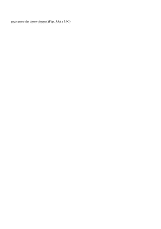 paços entre elas com o cimento. (Figs. 5.9A a 5.9G)
 