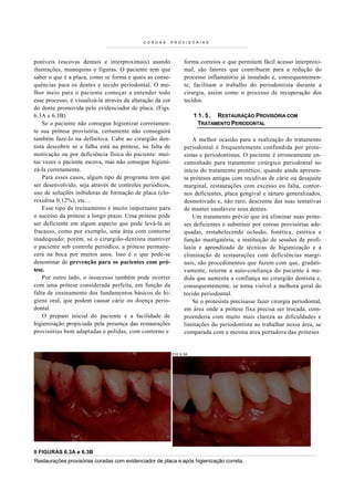 COROAS         PROVISÓRIAS




poníveis (escovas dentais e interproximais) usando                forma correios e que permitem fácil acesso interproxi-
ilustrações, manequins e figuras. O paciente tem que              mal, são fatores que contribuem para a redução do
saber o que é a placa, como se forma e quais as conse-            processo inflamatório já instalado e, consequentemen-
quências para os dentes e tecido periodontal. O me-               te, facilitam o trabalho do periodontista durante a
lhor m eio para o paciente co meçar a entender todo               cirurgia, assim como o processo de recuperação dos
esse processo, é visualizá-la através da alteração da cor         tecidos.
do dente promovida pelo evidenciador de placa. (Figs.
6.3A e 6.3B)                                                           1 1 . 5 . RESTAURAÇÃO PROVISÓRIA COM
    Se o paciente não consegue higienizar corretamen-                    TRATAMENTO PERIODONTAL
te sua prótese provisória, certamente não conseguirá
também faze-lo na definitiva. Cabe ao cirurgião den-                  A melhor ocasião para a realização do tratamento
tista descobrir se a falha está na prótese, na falta de           periodontal é frequentemente confundida por prote-
motivação ou por deficiência física do paciente: mui-             sistas e periodontistas. O paciente é erroneamente en-
tas vezes o paciente escova, mas não consegue higieni-            caminhado para tratamento cirúrgico periodontal no
zá-la corretamente.                                               início do tratamento protético, quando ainda apresen-
    Para esses casos, algum tipo de programa tem que              ta próteses antigas com recidivas de cárie ou desajuste
ser desenvolvido, seja através de controles periódicos,           marginal, restaurações com excesso ou falta, contor-
uso de soluções inibidoras de formação de placa (clo-             nos deficientes, placa gengival e tártaro generalizados,
rexidina 0,12%), etc...                                           desmotivado e, não raro, descrente das suas tentativas
    Esse tipo de treinamento é muito importante para              de manter saudáveis seus dentes.
o sucesso da prótese a longo prazo. Uma prótese pode                  Um tratamento prévio que irá eliminar suas próte-
ser deficiente em algum aspecto que pode levá-la ao               ses deficientes e substituir por coroas provisórias ade-
fracasso, como por exemplo, uma área com contorno                 quadas, restabelecendo oclusão, fonética, estética e
inadequado; porém, se o cirurgião-dentista mantiver               função mastigatória; a instituição de sessões de profi-
o paciente sob controle periódico, a prótese permane-             laxia e aprendizado de técnicas de higienização e a
cerá na boca por muitos anos. Isso é o que pode-se                eliminação de restaurações com deficiências margi-
denominar de prevenção para os pacientes com pró-                 nais, são procedimentos que fazem com que, gradati-
tese.                                                             vamente, retorne a auto-confiança do paciente à me-
    Por outro lado, o insucesso também pode ocorrer               dida que aumenta a confiança no cirurgião dentista e,
com uma prótese considerada perfeita, em função da                consequentemente, se torna visível a melhora geral do
falta de ensinamento dos fundamentos básicos de hi-               tecido periodontal.
giene oral, que podem causar cárie ou doença perio-                   Se o protesista precisasse fazer cirurgia periodontal,
dontal.                                                           em área onde a prótese fixa precisa ser trocada, com-
    O preparo inicial do paciente e a facilidade de               preenderia com muito mais clareza as dificuldades e
higienização propiciada pela presença das restaurações            limitações do periodontista ao trabalhar nessa área, se
provis órias bem adaptadas e polidas, com contorno e              comparada com a mesma área portadora das próteses


                                                            FIG 6.3A




II FIGURAS 6.3A e 6.3B
Restaurações provisórias coradas com evidenciador de placa e após higienização correta.
 