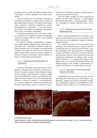 PRÓTESE       FI XA



    provisórias que, ao serem removidas, provêem acesso,            clínica deve ser feito para melhorar a retenção da pró-
    visualização e controle adequado dos tecidos perio-             tese sem comprometer a estética.
    dontais.                                                            Esses são alguns exemplos de como a presença da
        Assim, o momento de se encaminhar o paciente ao             prótese provisória pode aprimorar o relacionamento
    tratamento periodontal é quando ele já é capaz de               periodontista/protesista e, consequentemente, melho-
    fazer higienização aceitável, seus dentes foram prepa-          rar a qualidade do trabalho definitivo (Figs. 6.4A a
    rados, receberam tratamento endodôntico, núcleos                6.4F).
    intrarradiculares, se necessário, e coroas provisórias.
    Sua oclusão e desoclusão são adequadas, sua mastiga-                    1 . 5 . 2 . CONTROLE DA POSIÇÃO DEFINITIVA DA
    ção é efetiva, sua estética é satisfatória.                             MARGEM GENCIVAL
        O tratamento periodontal por necessidade protéti-
    ca é realizado em 2 situações: tratamento da patologia             Após a cirurgia periodontal deve-se aguardar a for-
    existente em tecido mole e/ou ósseo e, por exigência            mação do sulco gengival, que ocorre em torno de 60
    estética ou mecânica.                                           dias, para levar com segurança a margem do preparo
        Na primeira situação, procedimentos cirúrgicos              subgengivalmente.
    como gengivoplastia, gengivectomia, osteotomia, en-                 Se a prótese provisória estiver bem polida, bem
    xerto ósseo, etc... visam buscar a saúde do tecido peri-        adaptada e com contorno correto, o trauma mecânico
    odontal enquanto que, na segunda, os procedimentos              causado pela broca no epitélio sulcular durante o pre-
    cirúrgicos do aumento de coroa clínica, aumento do              paro subgengival, não apresentará graves consequênci-
    espaço interproximal, enxerto de tecido conjuntivo e            as para o periodonto, desde que a extensão intra-sul-
    enxerto de mucosa ceratinizada, buscam melhorar as              cular não seja excessiva, e que a prótese provisória seja
    relações estético/funcionais da prótese.                        reembasada corretamente. De qualquer modo, é acon-
                                                                    selhável esperar-se 2 a 3 semanas para realizar a mol-
         1 . 5 . 1 ' ORIENTAÇÃO DOS PROCEDIMENTOS                   dagem, para se ter certeza da localização definitiva da
         CIRÚRGICOS                                                 margem gengival. Este cuidado é extremamente im-
                                                                    portante nas próteses envolvendo dentes anteriores.
        A presença da prótese provisória auxilia o perio-
    dontista a conseguir mais facilmente os requisitos es-                  1 . 5 . 5 . AVALIAÇÃO DO CRAU DE MOBILIDADE
    téticos e funcionais durante os procedimentos cirúrgi-                  DOS DENTES PILARES
    cos. Por exemplo, onde posicionar o retalho na região
    cervical sem prejudicar a estética; necessidade de colo-            O planejamento de uma prótese fixa deve ser feito
    cação de enxerto conjuntivo em área desdentada para             em função das características dos dentes pilares e, em
    melhorar o contorno do pôntico e, consequentemen-               particular, naqueles com doença periodontal avança-
    te, a estética; aumento do espaço inter-proximal para           da. A diminuição, aumento ou estabilidade da mobi-
    facilitar a higienização; quanto de aumento de coroa            lidade dos dentes pilares deve ser avaliada durante a


                                                               FIG 6.4A




    S FIGURAS 6.4A E 6.4B
    Vistas vestibular e incisai mostrando desnivelamento gengival acentuado entre os dentes 13 e 21 e perda de estrutura
    óssea na área desdentada no sentido vestíbulo-palatino.




_
 