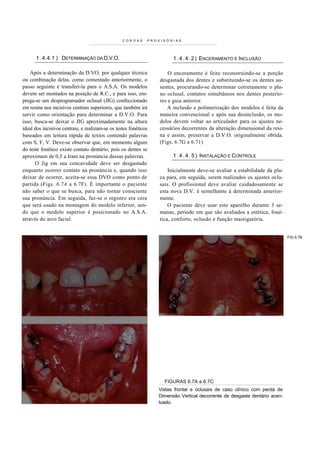 COROAS      PROVISÓRIAS




      1 .4.4.1 ) DETERMINAÇÃO DA D.V.O.                                 1 . 4 . 4 . 2 ) ENCERAMENTO E INCLUSÃO

    Após a determinação da D.VO. por qualquer técnica                 O enceramento é feito reconstruindo-se a porção
ou combinação delas, como comentado anteriormente, o              desgastada dos dentes e substituindo-se os dentes au-
passo seguinte é transferi-la para o A.S.A. Os modelos            sentes, procurando-se determinar corretamente o pla-
devem ser montados na posição de R.C., e para isso, em-           no oclusal, contatos simultâneos nos dentes posterio-
prega-se um desprogramador oclusal (JIG) confeccionado            res e guia anterior.
em resina nos incisivos centrais superiores, que também irá          A inclusão e polimerização dos modelos é feita da
servir como orientação para determinar a D.V.O. Para              maneira convencional e após sua desinclusão, os mo-
isso, busca-se deixar o JIG aproximadamente na altura             delos devem voltar ao articulador para os ajustes ne-
ideal dos incisivos centrais, e realizam-se os testes fonéticos   cessários decorrentes da alteração dimensional da resi-
baseados em leitura rápida de textos contendo palavras            na e assim, preservar a D.V.O. originalmente obtida.
com S, F, V. Deve-se observar que, em momento algum               (Figs. 6.7G a 6.71)
do teste fonético existe contato dentário, pois os dentes se
aproximam de 0,5 a Iram na pronúncia dessas palavras.                   1 . 4 . 4 . 5 ) INSTALAÇÃO E CONTROLE
      O Jig em sua concavidade deve ser desgastado
enquanto ocorrer contato na pronúncia e, quando isso                  Inicialmente deve-se avaliar a estabilidade da pla-
deixar de ocorrer, aceita-se essa DVO como ponto de               ca para, em seguida, serem realizados os ajustes oclu-
partida (Figs. 6.7A a 6.7F). É importante o paciente              sais. O profissional deve avaliar cuidadosamente se
não saber o que se busca, para não tornar consciente              esta nova D.V. é semelhante à determinada anterior-
sua pronúncia. Em seguida, faz-se o registro era cera             mente.
que será usado na montagem do modelo inferior, sen-                   O paciente deve usar este aparelho durante 3 se-
do que o modelo superior é posicionado no A.S.A.                  manas, período em que são avaliados a estética, foné-
através do arco facial.                                           tica, conforto, oclusão e função mastigatória.


                                                                                                                            FIG 6.7B




                                                                    FIGURAS 6.7A a 6.7C
                                                                  Vistas frontal e oclusais de caso clínico com perda de
                                                                  Dimensão Vertical decorrente de desgaste dentário acen-
                                                                  tuado.
 