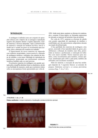 M O L D A G E M   E   M O D E L O     DE   T R A B A L H O




             INTRODUÇÃO                                                          1950. Ainda nesta época surgiram as siliconas de condensa-
                                                                                 ção e, somente 10 anos depois, na Alemanha, apareceram
           A moldagem é definida como um conjunto de opera-                      no mercado os materiais de borracha à base de poliéter.
       ções clínicas com o objetivo de se conseguir a reprodução                     Por volta de 1975, surgiram as siliconas de adição
       negativa dos preparos dentais e regiões adjacentes, usan-                 com grande capacidade de reprodução de detalhes e
       do materiais e técnicas adequadas. Após a polimerização                   estabilidade, por não apresentarem subprodutos durante
       do material e remoção da moldeira da boca, tem-se o                       sua reação de polimerização.
       molde que é vazado em gesso ou revestimento para mo-                          A boa qualidade dos materiais de moldagem e dos
       delos, para a obtenção dos modelos de trabalho.                           gessos, associado à boa reprodutividade do gesso, pos-
           O aparecimento de novos materiais de impressão                        sibilitaram a obtenção de modelos mais fiéis, permi-
       com melhores propriedades, tornou possível a obtenção                     tindo ao técnico e profissional, a realização de traba-
       de moldagens unitárias e múltiplas com redução do tem-                    lhos com maior exatidão. Outros materiais para mo-
       po de trabalho e com maior fidelidade de reprodução de                    delos, como revestimentos para modelos, resinas epó-
       pormenores, propiciando aos profissionais estruturas                      xicas, metalização pelo cobre e pela prata, também são
       metálicas fundidas cada vez mais precisas.                                utilizados com excelentes resultados.
           Os primeiros materiais de moldagem com grande acei-                       Além do material, a execução de uma boa molda-
       tação pelos cirurgiÕes-dentistas foram os elastômeros, devido             gem depende de 3 requisitos básicos: a) extensão do
       à sua facilidade de manuseio, sendo que os primeiros relatos              preparo; b)término cervical e c) coroas provisórias
       sobre as mercapatanas foram apresentados por volta de                     corretas (Figs. 7. IA a 7.1C).

                                                                                                                                              FIG 7 . I B




7.IA

       «FIGUR AS 7 . I A e 7 . I B
       Vistas vestibular e incisai mostrando a localização cometa do término cervical.




                                                                                   FIGURA 7.1
                                                                                 Vista frontal das coroas provisórias.
7.IC
 