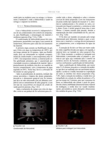 PRÓTESE   FIXA



usado tanto na moldeira como na seringa, e a técnica       cundar todo o dente, adaptando-o sobre o término
mista ("sanduíche"), onde o hidrocolóide é usado na        cervical do dente preparado. Com um instrumento
seringa e o alginato na moldeira.                          de ponta romba tipo espátula de inserção n° 2, intro-
                                                           duz-se cuidadosamente o fio retrator no sulco, co-
     5 . 1 . 1 . TÉCNICA CONVENCIONAL:                     meçando por lingual ou palatino e, contorna-se todo
                                                           o dente. Como o tecido gengival nessa área é mais
    Com o hidrocolóide reversível é indispensável o        fibroso, o trauma causado pela pressão, durante a
uso de um condicionador com controle de temperatu-         superposição das duas extremidades do fio, será me-
ra, para fluidificação e armazenagem do material e         nor. (Fig. 7.2D)
moldeiras especiais (Figs. 7.2A e 7.2B).                        O fio deve ser mantido em posição pelo tempo
    O condicionador de hidrocolóide possuí três com-       determinado pelo fabricante, durante o qual, a mol-
partimentos, preenchidos com água e com controle de        deira com o material e a seringa devem permanecer
temperatura, diferentes para cada fase de tratamento       no compartimento, com a temperatura da água em
do material.                                               46°C.
    A primeira etapa consiste na fluidificação do gel,          A remoção do fio deve ser feita com muito cuida-
que é feita com água na temperatura de 100°C, por          do, toda a superfície lavada com água e, em seguida, o
um tempo mínimo de 10 minutos. Após sua fluidifi-          material deve ser injetado no sulco gengival (Fig.
cação, deve ser armazenado no segundo comparti-            7.2E). Neste momento, a moldeira já carregada com
mento do condicionador, a uma temperatura entre 63         hidrocolóide é posicionada sobre os preparos e, per-
e 69°C. Em temperatura inferior, o material pode so-       mite-se que água seja conduzida para o interior da
frer geleificação prematura, que é caracterizada por       moldeira através da borracha condutora, para que
viscosidade excessiva e indesejável do material. Após o    ocorra o resfriamento e geleificação do hidrocolóide.
preenchimento da moldeira, esta deve ser mantida no             Após a geleificação do hidrocolóide, que ocorre
terceiro compartimento, com a temperatura da água          entre 5 e 8 minutos, procede-se a remoção da moldei-
regulada em 46°C. Nesta fase, faz-se a colocação do        ra, que deve ser realizada com um movimento único e
fio retrator no sulco gengival.                            rápido, e avalia-se o molde, buscando-se a reprodução
     Após os procedimentos de anestesia, remoção das       de todos os detalhes dos dentes preparados (Fig.
coroas provisórias e limpeza dos dentes preparados,        7.2F). Após a remoção da moldeira, o molde deve ser
procede-se o afastamento gengival com fio retrator,        mergulhado em solução de sulfato de potássio a 2%,
que deve ter sido selecionado com um diâmetro com-         por um tempo de 5 minutos, para que a presença do
patível com as características do sulco gengival, e com    bórax no hidrocolóide não retarde a presa do gesso.
um tipo de vasocontrítor em função do estado de            Devido à baixa estabilidade dimensional deste material
saúde geral do paciente. (Fig. 7.2C)                       de moldagem, o molde deve ser vazado imediata-
     Após o isolamento do campo com rolos de algo-         mente, prevenindo-se assim alterações dimensionais
dão, corta-se um pedaço de fio suficiente para cir-        dos modelos de gesso. (Fig. 7.2G)




■ FIGURA 7.2A                                              ■ FIGURA 7.2B
Condicionador de hidrocolóide.                             Moldeira para moldagem com hidrocolóide.
 