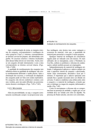 M O L D A C E M   E   M O D E L O     DE   T R A B A L H O




                                                                      ■ FIGURA 7.6J
                                                                      Avaliação do reembasamento dos casquetes.



   Após a polimerização da resina, as margens exter-                  boa moldagem, esta técnica tem como vantagem a
nas do casquete, correspondentes à moldagem do                        economia de material, visto que, a quantidade do
sulco gengival ("saia"), e internas, correspondentes                  material para preencher o casquete é muito pequena.
ao término cervical do preparo, são delimitadas com                       Qualquer material de moldagem de consistência
grafite. Os excessos externos e internos localizados                  regular pode ser indicado com esta técnica. Os mais
além dessas linhas devem ser removidos. Assim, tem-                   utilizados são as mercaptanas, como o Permlastic ou
se um casquete aliviado internamente e com a área                     Coe-flex, embora os poliéteres e siliconas de conden-
correspondente ao término cervical intacta. (Figs.                    sação e adição também possam ser empregados.
7.6K a 7.6M)                                                              Independentemente do material de moldagem uti-
   A qualidade do reembasamento dos casquetes tem                     lizado, é indispensável aplicar-se o adesivo próprio em
influência direta na qualidade da moldagem: não exis-                 toda a superfície interna do casquete e aproximada-
te reembasamento deficiente e molde preciso. Após a                   mente 2mm externamente, deixando-o secar por 5
eliminação dos excessos, a verificação da adaptação                   minutos. É importante que o adesivo apresente uma
dos casquetes pode ser feita com sonda exploradora.                   camada fina e quando necessário deve ser diluído em
Os casquetes não devem estabelecer contatos com                       solvente. O adesivo estabelece uma sólida união entre
seus vizinhos, pois isto pode dificultar seu posiciona-               o casquete e o material de moldagem, evitando que
mento durante a moldagem. (Figs. 7.6N e 7.6O).                        este se desloque ou rasgue do casquete, deformando o
                                                                      molde. (Fig. 7.6P)
  I 4.5. MOLDAGEM                                                         Como as mercaptanas e siliconas não se compor-
                                                                      tam bem na presença de umidade, a região que vai ser
   Além da previsibilidade, ou seja, o casquete corre-                moldada deve ser isolada com rolos de algodão. Na
tamente reembasado sempre vai proporcionar uma                        presença de fluido sulcular, este deve ser controlado,


                                                                                                                                FIG 7.6L




■ FIGURAS 7.6K e 7.6L
Remoção dos excessos externos e internos do casquete
 