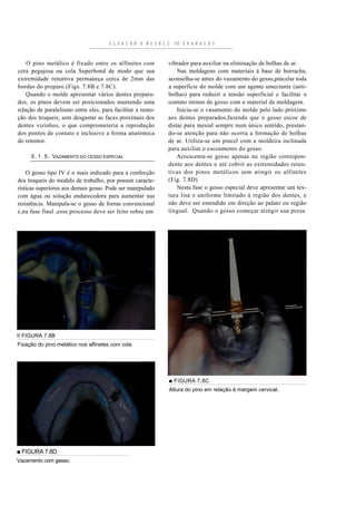 O L D A C E M E M O D E L O DE T R A B A L H O


    O pino metálico é fixado entre os alfinetes com            vibrador para auxiliar na eliminação de bolhas de ar.
cera pegajosa ou cola Superbond de modo que sua                    Nas moldagens com materiais à base de borracha,
extremidade retentiva permaneça cerca de 2mm das               aconselha-se antes do vazamento do gesso,pincelar toda
bordas do preparo (Figs. 7.8B e 7.8C).                         a superfície do molde com um agente umectante (anti-
    Quando o molde apresentar vários dentes prepara-           bolhas) para reduzir a tensão superficial e facilitar o
dos, os pinos devem ser posicionados mantendo uma              contato íntimo do gesso com o material de moldagem.
relação de paralelismo entre eles, para facilitar a remo-          Inicia-se o vasamento do molde pelo lado próximo
ção dos troqueis, sem desgastar as faces proximais dos         aos dentes preparados,fazendo que o gesso escoe de
dentes vizinhos, o que comprometeria a reprodução              distai para mesial sempre num único sentido, prestan-
dos pontos de contato e inclusive a forma anatómica            do-se atenção para não ocorra a formação de bolhas
do retentor.                                                   de ar. Utiliza- se um pincel com a moldeira inclinada
                                                               para auxiliar o escoamento do gesso.
     5 . 1 . 5 . VAZAMENTO DO CESSO ESPECIAL                      Acrescenta-se gesso apenas na região correspon-
                                                               dente aos dentes e até cobrir as extremidades reten-
    O gesso tipo IV é o mais indicado para a confecção         tivas dos pi nos metáli cos sem atingir os alfinetes
dos troqueis do modelo de trabalho, por possuir caracte-       (Fig. 7.8D)
rísticas superiores aos demais gesso. Pode ser manipulado          Nesta fase o gesso especial deve apresentar um tex-
com água ou solução endurecedora para aumentar sua             tura lisa e uniforme limitado à região dos dentes, e
resistência. Manipula-se o gesso de forma convencional         não deve ser estendido em direção ao palato ou região
e,na fase final ,esse pro cesso de ve ser feito sobre um       lingual. Quando o gesso começar atingir sua presa




II FIGURA 7.8B
Fixação do pino metálico nos alfinetes com cola




                                                                ■ FIGURA 7.8C
                                                                Altura do pino em relação à margem cervical.




■ FIGURA 7.8D
Vazamento com gesso.
 