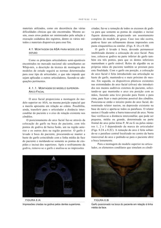 PRÓTESE   FIXA



materiais utilizados, como em decorrência das várias         criadas; faz-se a remoção de todos os excessos de godi-
dificuldades clínicas que são encontradas. Mesmo as-         va para que somente as pontas de cúspides e incisai
sim, esses erros podem ser minimizados pela seleção e        fiquem demarcadas, propiciando um assentamento
execução cuidadosa dos registros, dentre os vários mé-       completo do modelo de gesso. Caso isso não ocorra,
todos e materiais disponíveis para esse fim.                 pode-se fazer um refinamento dessas impressões com
                                                             pasta zinquenólica ou similar. (Figs. 8. IA e 8.1B)
     4.1. M ONTAGEM     EM   ASA   PARA MODELOS DE               O garfo é levado à boca, devendo permanecer
     ESTUDO                                                  imobilizado durante a colocação do arco facial. Para
                                                             isso, coloca-se godiva na parte inferior do garfo tam-
     Como os principais articuladores semi-ajustáveis        bém era três pontos, para que os dentes inferiores
encontrados no mercado nacional são semelhantes ao           mantenham o garfo estável. Rolos de algodão ou as
Whip-mix, a descrição da técnica de montagem dos             próprias mãos do paciente também se prestam para
modelos de estudo seguirá as normas determinadas             esta finalidade. Com o garfo em posição, a colocação
para esse tipo de articulador, o que não impede que          do arco facial é feita introduzindo sua articulação na
sejam aplicadas a outros articuladores, fazendo-se ade-      haste do garfo, mantendo-a o mais próximo do mes-
quações pertinentes.                                         mo. Em seguida, os dispositivos plásticos existentes
                                                             nas extremidades do arco facial (olivas) são introduzi-
     4 . 1 . 1 . MONTAGEM DO MODELO SUPERIOR-                dos nos meatos auditivos externos do paciente, solici-
     ARCO FACIAL                                             tando-se que mantenha o arco era posição com as
                                                             mãos, fazendo uma leve pressão para frente e para
      O arco facial proporciona a montagem do mo-            cima, para ficar o mais próximo possível dos côndilos.
delo superior no ASA, na mesma posição espacial que          Posiciona-se então o terceiro ponto do arco facial, de-
a maxila apresenta em relação ao crânio. Possibilita,        nominado relator nasion, na depressão existente na
ainda, transferir para o articulador a distância inter-      base do nariz e aperta-se todos os parafusos. O relator
condilar do paciente e o eixo de rotação existente nos       nasion é fixado sobre a barra transversal do arco. Nesta
côndilos.                                                    fase verifica-se a distância intercondilar, que pode ser
    O posicionamento do arco facial faz-se através da        pequena, média ou grande, determinada na parte
colocação do garfo na boca do paciente, com três             frontal do arco pelas letras P, M ou G ou pelos núme-
pontos de godiva de baixa fusão, um na região ante-          ros 1, 2 e 3 dependendo da marca do articulador
rior e os outros dois na região posterior. O garfo é         (Figs. 8.2A a 8.2C). A remoção do arco é feita soltan-
levado à boca do paciente, procurando-se manter a            do-se o parafuso central localizado no centro da barra
haste do garfo coincidindo com a linha média da face         transversal do arco e pedindo-se para o paciente abrir
do paciente e moldando-se somente as pontas de cús-          a boca lentamente.
pides e incisai dos superiores. Após o resfriamento da             Para a montagem do modelo superior no articu-
godiva, remove-se o garfo e analisa-se as impressões         lador, os elementos condilares que simulam os côndi-




  FIGURA 8.IA                                                  FIGURA 8.IB
Impressões criadas na godiva pelos dentes superiores.        Garfo posicionado na boca do paciente em relação à linha
                                                             média da face.
 