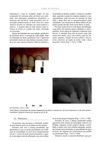 EXAME    DO   P A CI E NT E




importância o teste de vitalidade pulpar. Se esta            elasticidade da dentina, modifica o limiar de excitabili-
restauração for realizada sobre um dente sem vitali-         dade, sugerindo a perda de receptores pulpares e, con-
dade, sem tratamento endodôntico satisfatório, o             sequentemente, pode provocar um aumento da força
insucesso será inevitável, sendo necessário nova in-         sobre o dente antes que os mecanorreceptores sejam
tervenção posteriormente no local. Para isso, testes         estimulados. Este mecanismo de defesa (reflexo de pro-
térmicos deverão ser utilizados por serem práticos e         teção) quando alterado, pode causar danos ao dente.
efetivos. A resposta dada ao teste térmico pode in-              Por estas razões deve-se evitar dentes desvitalizados
formar ao clínico se a polpa está sadia, inflamada           como pilares de extensos espaços edentados e, princi-
ou necrosada.                                                palmente, como pilares de segmentos suspensos (can-
    Dentes desvitalizados têm uma redução significativa      tilever). A indicação deste tipo de prótese exige, pelo
da resistência física. A remoção do órgão pulpar, fonte      menos dois dentes vitais como pilares para um ele-
de hidratação do dente, juntamente com o ligamento           mento suspenso, redução da mesa oclusal e deve-se
periodontal resulta em uma dentina ressecada, tornan-        evitar colocá-los na região de molar, onde a força
do a raiz mais sujeita à fraturas. Diminui também a          muscular é maior (Figs. 1.14A e 1.14B).




                                             I




                      I        m         m
■ FIGURAS I.I4A e I.I4B
Vista lateral e radiográfica da prótese metalocerâmica tendo os dentes 24 e 25 como retentores e o 26 como pôntico
(cantilever). Observe a fratura por mesial da raiz do 25.



     5.2. PERIODONTO                                         do ao tecido gengival marginal (Figs. 1.15A e 1.15B);
                                                                 Pacientes de risco à doença periodontal podem
    Os pacientes que procuram o tratamento podem,            apresentar sinais clínicos de intensidade variável: mo-
de uma maneira geral, ser divididos em dois grupos:          bilidade, migração, tecido gengival flácido, averme-
    Pacientes sem risco à doença periodontal, que            lhado e muitas vezes sem contorno adequado, associa-
apresentam-se com os tecidos periodontais em condi-          dos à perda óssea (localizada ou generalizada) de graus
ções de normalidade: O nível ósseo frequentemente            diversos, são algumas das características que podem
está de 1 a 2mm da união amelo-cementária e, quan-           ser encontradas (Figs. 1.16A e 1.16B).
do existe algum sinal de inflamação, este está confina-          Durante o exame é essencial identificar a que gru-
 