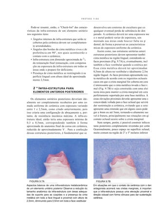 PRÓTESE FIXA



    Pode-se resumir, então, o "Check-list" das caracte-    desenvolva um contorno de escultura que co
rísticas da infra-estrutura de um elemento unitário        qualquer eventual perda de substância do den
nos seguintes itens:                                       parado. A cerâmica deverá ter uma espessura me
                                                           e o metal poderá variar de espessura, sen
   • Ângulos internos da infra-estrutura que serão re
                                                           mentado nas áreas onde houver falta no p
     cobertos pela cerâmica devem ser completamen-
                                                           dental, de forma a preservar as características
     te arrendodados;
                                                           micas de espessura uniforme da cerâmica.
   • Ângulos das bordas da cinta metálica vivos e de
                                                               Assim como, nas estruturas unitárias anteri
     preferência em 90°, nos quais acontecerão o
                                                           estruturas posteriores devem apresentar també:
     contato com a cerâmica;
                                                           cinta metálica na região lingual, estendendo-se
   • Infra-estrutura com dimensão aproximada de 2/3
                                                           faces proximais (Fig. 9.7A) e, eventualmente, incl
     da restauração final restauração, com compensa
                                                           também a face vestibular quando a estética pei
     ção na espessura da infra-estrutura em todas as
                                                           Essa cinta metálica deverá ter aproximadan
     áreas onde o preparo for deficiente;
                                                           0,5mm de altura na vestibular e idealmente 2,5m
   • Presença de cinta metálica se restringindo à su
                                                           região lingual. As faces proximais apresentarão ess;
     perfície lingual com altura ideal de aproximada
                                                           ta metálica de acordo com os requisitos oclusais
     mente 2,5mm.
                                                           casos em que a crista marginal for coberta em cera
                                                           é interessante que a cinta metálica invada a face r.
     2 * I NFRA - ESTRUTURA
                          PARA                             mal (Fig. 9.7B) e seja construída com uma elei
     ELEMENTOS UNITÁRIOS POSTERIORES                       nesta área para manter a crista marginal em cera
                                                           perfeitamente suportada por uma base metálica. A
    Os elementos unitários posteriores deveriam ide-       essas elevações proximais deverão apresentar uma s
almente ser completamente recobertos por uma ca-           concavidade voltada para a face oclusal que servirá
mada uniforme de cerâmica com espessura variando           dar sustentação a cerâmica, evitando que a cera:
entre 1 e 2,5mm, como citado anteriormente, pois           apresente uma extensão que em alguns casos pode
isso criaria uma configuração de abraçamento e, por-       gar a 4mm ou até 5mm, tornando-a altamente sus
tanto, de resistência mecânica máxima. A infra-es-         vel à fratura, principalmente nas situações em qi
trutura ideal, então teria uma espessura mínima de         contato oclusal ocorre sobre a crista marginal.
0,3 a 0,5mm, correspondendo também à forma                     Nem sempre, porém, é possível construir infra-es
aproximada da anatomia final da coroa em cerâmica,         turas posteriores completamente revestidas por cerân
reduzida de aproximadamente V . Para a confecção           Ocasionalmente, pouco espaço na superfície oclusal,
dessas estruturas posteriores, é fundamental que se        muito comum na região de 2o e 3o molares inferior




  FIGURA 9.7A                                                FIGURA 9.7B
Aspectos básicos de uma infra-estrutura metalocerâmica     Em situações em que o contato da cerâmica com o den
de um elemento unitário posterior Observe a redução do     antagonista acorrerá nas cristas marginais, é importan
tamanho anatómico da infra-estrutura com áreas adequa-     que a infra-estrutura possua uma elevação proximal e
das de suporte para as cúspides e a presença da cinta      direção oclusal com forma côncava para dar sustentaçãc
metálica em toda a face lingual e proximal com altura de   cerâmica.
2,5mm, diminuindo para 0,5mm em toda a face vestibular
 