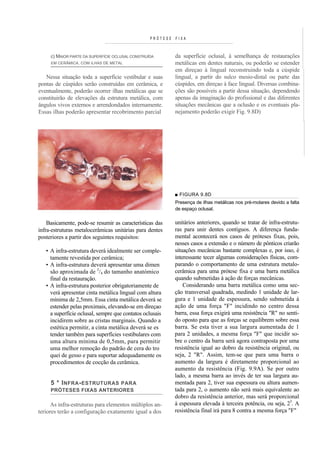 PRÓTESE   FIXA



     c) MAIOR PARTE DA SUPERFÍCIE OCLUSAL CONSTRUÍDA        da superfície oclusal, à semelhança de restaurações
     EM CERÂMICA, COM ILHAS DE METAL                        metálicas em dentes naturais, ou poderão se estender
                                                            em direçao à lingual reconstruindo toda a cúspide
   Nessa situação toda a superfície vestibular e suas       lingual, a partir do sulco mesio-distal ou parte das
pontas de cúspides serão construídas em cerâmica, e         cúspides, em direçao à face lingual. Diversas combina-
eventualmente, poderão ocorrer ilhas metálicas que se       ções são possíveis a partir dessa situação, dependendo
constituirão de elevações da estrutura metálica, com        apenas da imaginação do profissional e das diferentes
ângulos vivos externos e arrendondados internamente.        situações mecânicas que a oclusão e os eventuais pla-
Essas ilhas poderão apresentar recobrimento parcial         nejamento poderão exigir Fig. 9.8D)




                                                            ■ FIGURA 9.8D
                                                            Presença de ilhas metálicas nos pré-molares devido a falta
                                                            de espaço oclusal.

    Basicamente, pode-se resumir as características das     unitários anteriores, quando se tratar de infra-estrutu-
infra-estruturas metalocerâmicas unitárias para dentes      ras para unir dentes contíguos. A diferença funda-
posteriores a partir dos seguintes requisitos:              mental acontecerá nos casos de próteses fixas, pois,
                                                            nesses casos a extensão e o número de pônticos criarão
   • A infra-estrutura deverá idealmente ser comple-        situações mecânicas bastante complexas e, por isso, é
     tamente revestida por cerâmica;                        interessante tecer algumas considerações físicas, com-
   • A infra-estrutura deverá apresentar uma dimen          parando o comportamento de uma estrutura metalo-
     são aproximada de 3/4 do tamanho anatómico             cerâmica para uma prótese fixa e uma barra metálica
     final da restauração.                                  quando submetidas à ação de forças mecânicas.
   • A infra-estrutura posterior obrigatoriamente de            Considerando uma barra metálica como uma sec-
     verá apresentar cinta metálica lingual com altura      ção transversal quadrada, medindo 1 unidade de lar-
     mínima de 2,5mm. Essa cinta metálica deverá se         gura e 1 unidade de espessura, sendo submetida à
     estender pelas proximais, elevando-se em direçao       ação de uma força "F" incidindo no centro dessa
     a superfície oclusal, sempre que contatos oclusais     barra, essa força exigirá uma resistência "R" no senti-
     incidirem sobre as cristas marginais. Quando a         do oposto para que as forças se equilibrem sobre essa
     estética permitir, a cinta metálica deverá se es       barra. Se esta tiver a sua largura aumentada de 1
     tender também para superfícies vestibulares com        para 2 unidades, a mesma força "F" que incidir so-
     uma altura mínima de 0,5mm, para permitir              bre o centro da barra será agora contraposta por uma
     uma melhor remoção do padrão de cera do tro            resistência igual ao dobro da resistência original, ou
     quei de gesso e para suportar adequadamente os         seja, 2 "R". Assim, tem-se que para uma barra o
     procedimentos de cocção da cerâmica.                   aumento da largura é diretamente proporcional ao
                                                            aumento da resistência (Fig. 9.9A). Se por outro
                                                            lado, a mesma barra ao invés de ter sua largura au-
     5 * I NFRA - ESTRUTURAS
                           PARA                             mentada para 2, tiver sua espessura ou altura aumen-
     PRÓTESES FIXAS ANTERIORES                              tada para 2, o aumento não será mais equivalente ao
                                                            dobro da resistência anterior, mas será proporcional
      As infra-estruturas para elementos múltiplos an-      à espessura elevada à terceira potência, ou seja, 23. A
teriores terão a configuração exatamente igual a dos        resistência final irá para 8 contra a mesma força "F"
 
