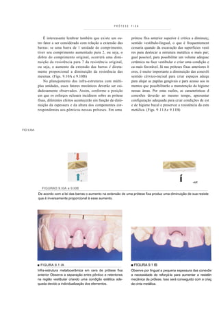 PRÓTESE   FIXA



                É interessante lembrar também que existe um ou-         prótese fixa anterior superior é critica a diminuiç;
            tro fator a ser considerado com relação a extensão das      sentido vestibulo-lingual, o que é frequentement
            barras: se uma barra de 1 unidade de comprimento,           cessaria quando da escavação das superfícies vesti
            tiver seu comprimento aumentado para 2, ou seja, o          res para deslocar a estrutura metálica o mais par;
            dobro do comprimento original, ocorrerá uma dimi-           gual possível, para possibilitar um volume adequac
            nuição da resistência para 7 da resistência original,       cerâmica na face vestibular e criar uma condição e
            ou seja, o aumento da extensão das barras é direta-         ca mais favorável. Já nas próteses fixas anteriores h
            mente proporcional a diminuição da resistência das          ores, é muito importante a diminuição das conexõi
            mesmas. (Figs. 9.10A e 9.10B)                               sentido cérvico-incisal para criar espaços adequ
                No planejamento das infra-estruturas com múlti-         para alojar as papilas gengivais e para acesso aos in
            plas unidades, esses fatores mecânicos deverão ser cui-     mentos que possibilitarão a manutenção da higiene
            dadosamente observados. Assim, conforme a posição           nessas áreas. Por estas razões, as características d
            em que os esforços oclusais incidirem sobre as prótese      conexões deverão ao mesmo tempo, apresentar
            fixas, diferentes efeitos acontecerão em função da dimi-    configuração adequada para criar condições de est
            nuição da espessura e da altura dos componentes cor-        e de higiene bucal e preservar a resistência da estn
            respondentes aos pônticos nessas próteses. Em uma           metálica. (Figs. 9.11Ae 9.11B)




FIG 9.I0A




                                                                                                        í        •AR

              FIGURAS 9.I0A e 9.I0B
            De acordo com a lei das barras o aumento na extensão de uma prótese fixa produz uma diminuição de sua resiste
            que é inversamente proporcional à esse aumento.




            ■ FIGURA 9.1 IA                                             ■ FIGURA 9.1 IB
            Infra-estrutura metalocerâmica em cera de prótese fixa      Observe por lingual a pequena espessura das conexõe
            anterior Observe a separação entre pôntico e retentores     a necessidade de reforçá-la para aumentar a resistên
            na região vestibular criando uma condição estética ade-     mecânica da prótese. Isso será conseguido com a criaç
            quada devido a individualização dos elementos.              da cinta metálica.
 
