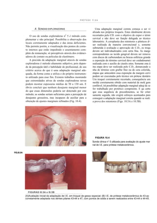 PRÓTESE   F I X A



                    .4. SONDAS EXPLORADORAS                                   Uma adaptação marginal correta começa a ser vi
                                                                           alizada nos próprios troqueis. Estes idealmente devem
                O uso de sondas exploradoras n2 5 é método com-            recortados pelo CD. com o objetivo de expor o térmi
            plementar e não principal. Possibilita a observação dos        cervical e não deve ser função delegada ao técnico
                                                                           laboratório. A ceroplastia dos retentores e pônticos d<
            locais corretamente adaptados e das áreas deficientes.
                                                                           ser realizada da maneira convencional e, somente
            Não permite porém, a visualização dos pontos de conta-
                                                                           submetida à avaliação e aprovação do C.D., os troqu
            to internos que estão impedindo o assentamento com-            devem ser individualizados com serra fina. As margc
            pleto da restauração, só perceptíveis através dos evidenci-    correspondentes ao tecido gengival devem ser removu
            adores de contato ou películas de elastômero.                  com discos de carborundum ou brocas esféricas grande
                A precisão da adaptação marginal através de sondas         a exposição do término cervical deve ser cuidadosamei
            exploradoras é método altamente subjetivo, pois depen-         realizada com o auxílio de cinzéis retos. Somente esta ú
            de da percepção tátil e habilidade do profissional, do seu     ma etapa deve ser realizada pelo C.D., demarcando a
            critério acerca do que é uma adaptação marginal ade-           nha de término com grafite fino ou de cera colorida,
            quada, da forma como a utiliza e do próprio instrumen-         etapas que antecedem essa exposição da margem cervi
            to utilizado para esse fim. Existem trabalhos mostrando        podem ser executadas pelo técnico em prótese dentáris
            que extremidades ativas de sondas exploradoras novas           Um troquei corretamente recortado, consequência um
                                                                           molde corretamente obtido com material de mol( gem
            podem mostrar espessuras médias de 50 a 130 um. E
                                                                           confiável, irá possibilitar adaptação marginal adeqi da se
            óbvio concluir que nenhum desajuste marginal menor             for trabalhado por protético competente. E qu certo
            do que essas dimensões poderia ser detectado por este          que essa sequência de procedimentos, se for criter
            método; as sondas seriam suficientes para a percepção de       samente seguida, não exigirá esforços acentuados para
            desajustes grosseiros, mas incapazes de auxiliar para a        conseguir a adaptação marginal correta quando se reali:
            obtenção de ajustes marginais refinados (Fig. 10.4).           a prova dos retentores (Figs. 10.5A e 10.5B).




                                                                              FIGURA 10.4
                                                                           Sonda clínica n° 5 utilizada para avaliação do ajuste mar
                                                                           nal de I.E. para prótese metalocerâmica.


FIG.I0.5A




              FIGURAS I0.5A e I0.5B
            (A)Avaliação inicial da adaptação de I.E. em troquei de gesso especial; (B) I.E. de prótese metalocerâmica do 43 ao
            corretamente adaptada nos dentes pilares 43-44 e 47, com pontos de solda a serem realizados entre 43-44 e 44-45.
 