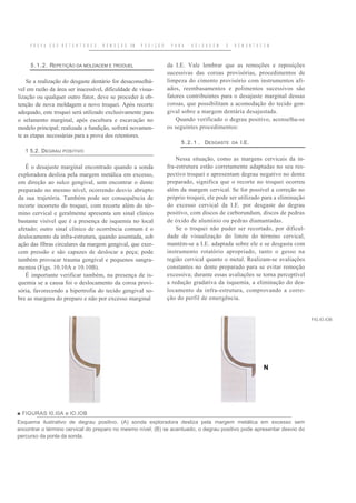P R O V A   D O S R E T E N T O R E S ,   R E M O Ç Ã O   EM   P O S I Ç Ã O    P A R A   S O L D A G E M   E   R E M O N T A C E M



     5 . 1 . 2 . REPETIÇÃO DA MOLDACEM E TROOUEL                                    da I.E. Vale lembrar que as remoções e reposições
                                                                                    sucessivas das coroas provisórias, procedimentos de
    Se a realização do desgaste dentário for desaconselhá-                          limpeza do cimento provisório com instrumentos afi-
vel em razão da área ser inacessível, dificuldade de visua-                         ados, reembasamentos e polimentos sucessivos são
lização ou qualquer outro fator, deve se proceder à ob-                             fatores contribuintes para o desajuste marginal dessas
tenção de nova moldagem e novo troquei. Após recorte                                coroas, que possibilitam a acomodação do tecido gen-
adequado, este troquei será utilizado exclusivamente para                           gival sobre a margem dentária desajustada.
o selamento marginal, após escultura e escavação no                                     Quando verificado o degrau positivo, aconselha-se
modelo principal; realizada a fundição, sofrerá novamen-                            os seguintes procedimentos:
te as etapas necessárias para a prova dos retentores.
                                                                                          5 . 2 . 1 . DESGASTE       DA   I.E.
   1 5.2. D EGRAU POSITIVO
                                                                                        Nessa situação, como as margens cervicais da in-
   É o desajuste marginal encontrado quando a sonda                                 fra-estrutura estão corretamente adaptadas no seu res-
exploradora desliza pela margem metálica em excesso,                                pectivo troquei e apresentam degrau negativo no dente
em direção ao sulco gengival, sem encontrar o dente                                 preparado, significa que o recorte no troquei ocorreu
preparado no mesmo nível, ocorrendo desvio abrupto                                  além da margem cervical. Se for possível a correção no
da sua trajetória. Também pode ser consequência de                                  próprio troquei, ele pode ser utilizado para a eliminação
recorte incorreto do troquei, com recorte além do tér-                              do excesso cervical da I.E. por desgaste do degrau
mino cervical e geralmente apresenta um sinal clínico                               positivo, com discos de carborundum, discos de pedras
bastante visível que é a presença de isquemia no local                              de óxido de alumínio ou pedras diamantadas.
afetado; outro sinal clínico de ocorrência comum é o                                    Se o troquei não puder ser recortado, por dificul-
deslocamento da infra-estrutura, quando assentada, sob                              dade de visualização do limite do término cervical,
ação das fibras circulares da margem gengival, que exer-                            mantém-se a I.E. adaptada sobre ele e se desgasta com
cem pressão e são capazes de deslocar a peça; pode                                  instrumento rotatório apropriado, tanto o gesso na
também provocar trauma gengival e pequenos sangra-                                  região cervical quanto o metal. Realizam-se avaliações
mentos (Figs. 10.10A e 10.10B).                                                     constantes no dente preparado para se evitar remoção
   É importante verificar também, na presença de is-                                excessiva; durante essas avaliações se torna perceptível
quemia se a causa foi o deslocamento da coroa provi-                                a redução gradativa da isquemia, a eliminação do des-
sória, favorecendo a hipertrofia do tecido gengival so-                             locamento da infra-estrutura, comprovando a corre-
bre as margens do preparo e não por excesso marginal                                ção do perfil de emergência.


                                                                                                                                                FIG.IO.IOB




                                                                                                                                     N




■ FIGURAS I0.I0A e lO.IOB
Esquema ilustrativo de degrau positivo. (A) sonda exploradora desliza pela margem metálica em excesso sem
encontrar o término cervical do preparo no mesmo nível; (B) se acentuado, o degrau positivo pode apresentar desvio do
percurso da ponta da sonda.
 