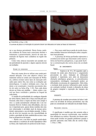 E X A M E   DO   PACIENTE




■ FIGURAS LI7Ae I.I7B
O controle de placa e a motivação do paciente devem ser efetuados em todas as fases do tratamento.



rar a sua doença periodontal. Desta forma, pode-                   — Nos casos onde houve perda de tecido ósseo,
rão colaborar de forma mais consciente durante o                estas medidas fornecem informações sobre a arquite-
tratamento e posteriormente, através de uma ma-                 tura óssea presente;
nutenção da higiene mais cuidadosa na região das                   — A presença de bolsas profundas representa a
próteses.                                                       existência de nichos que funcionam como reserva
    Como visto, torna-se necessário um acurado exa-             tórios de bactérias patogênicas, o que pode facili
me periodontal do paciente e alguns aspectos devem              tar a contaminação das outras áreas da cavidade
ser avaliados:                                                  bucal.
                                                                             DE SANCRAMENTO
     EXAME   DE SONDAGEM                                            ÍNDICE
                                                                              Espera-se de 10 a 20 segundos após a
    Para este exame deve-se utilizar uma sonda peri-            remoção da sonda para observar-se o sangramento
odontal delicada. Com este objetivo clínico nor-                proveniente do sulco. Indicador de inflamação
malmente utiliza-se sonda com marcação de Willia-               marginal, é importante, pois além de demonstrar
ms, embora existam outros tipos de marcação utili-              alterações patológicas gengivais, os procedimentos
zados para outros fins, tais como as avaliações epi-            restauradores (moldagem, cimentação) podem ser
                                                                dificultados na presença de sangramento. Além disto,
demiológicas. A sonda é alinhada com a face do
                                                                a resolução deste processo inflamatório pode resultar
dente a ser examinado e inserida suavemente den-
                                                                em contração tecidual, levando à alterações da altura
tro do sulco ou bolsa (Fig. 1.18). Para cada dente
                                                                da gengiva marginal e exposição das margens das
devem ser feitas seis medidas — distai, centro e me-            coroas.
sial nas faces vestibular e palatina ou lingual de
cada dente.                                                          EXSUDATO
    A medida de profundidade de sondagem depende
de vários fatores, dentre eles a força exercida pelo pro-
                                                                   A presença de exsudato proveniente da bolsa é indi-
fissional, além disso o trajeto da bolsa nem sempre é
                                                                cativo de atividade da doença periodontal, mas não
reto e a sonda normalmente utilizada não é um ins-
                                                                pode ser considerado um indicador da atividade futura.
trumento flexível. Embora estas dificuldades, este exa-
me é importante pois, apesar destas medidas não esta-
                                                                     RECESSÃO   CENCIVAL
rem relacionadas à atividade atual da doença perio-
dontal, representam a sua atividades passada. A detec-
                                                                    E significante à medida que não somente afeta a
ção do nível de inserção nos dá a possibilidade de
                                                                quantidade de mucosa ceratinizada, mas também
avaliar a gravidade da lesão estabelecida na área e ana-
                                                                tem influência na estética. Recessão em dentes ante-
lisar as perspectivas de terapia:
                                                                riores pode resultar em grandes problemas quando o
    — Bolsas com a sua base na junção amelo-denti-
                                                                paciente apresenta uma linha alta do sorriso (Figs.
nária indicam a existência de tecido hiperplásico (Bol-
                                                                1.19Ae 1.19B).
sa falsa), não implicando em perda de tecido ósseo;
 