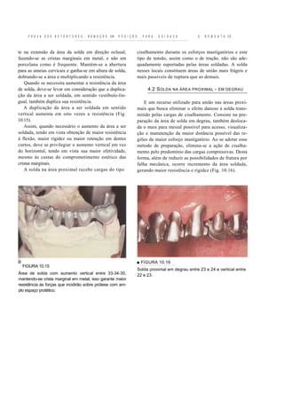 P R O V A   D O S   R E T E N T O R E S ,   R E M O Ç Ã O   EM   P O S I Ç Ã O     P A R A   S O I D A C E      E   R E M O N T A CE



te na extensão da área da solda em direção oclusal,                                   cisalhamento durante os esforços mastigatórios e este
fazendo-se as cristas marginais em metal, e não em                                    tipo de tensão, assim como o de tração, não são ade-
porcelana como é frequente. Mantém-se a abertura                                      quadamente suportadas pelas áreas soldadas. A solda
para as ameias cervicais e ganha-se em altura de solda,                               nesses locais constituem áreas de união mais frágeis e
dobrando-se a área e multiplicando a resistência.                                     mais passíveis de ruptura que as demais.
    Quando se necessita aumentar a resistência da área
de solda, deve-se levar em consideração que a duplica-                                     4.2 S OLDA      NA ÁREA PROXIMAL    -   EM DEGRAU
ção da área a ser soldada, em sentido vestíbulo-lin-
gual, também duplica sua resistência.                                                     E um recurso utilizado para união nas áreas proxi-
   A duplicação da área a ser soldada em sentido                                      mais que busca eliminar o efeito danoso à solda trans-
vertical aumenta em oito vezes a resistência (Fig.                                    mitido pelas cargas de cisalhamento. Consiste na pre-
10.15).                                                                               paração da área de solda em degrau, também desloca-
   Assim, quando necessário o aumento da área a ser                                   da o mais para mesial possível para acesso, visualiza-
soldada, tendo em vista obtenção de maior resistência                                 ção e manutenção da maior distância possível das re-
à flexão, maior rigidez ou maior retenção em dentes                                   giões de maior esforço mastigatório. Ao se adotar esse
curtos, deve se privilegiar o aumento vertical em vez                                 método de preparação, elimina-se a ação de cisalha-
do horizontal, tendo em vista sua maior efetividade,                                  mento pelo predomínio das cargas compressivas. Desta
mesmo às custas do comprometimento estético das                                       forma, além de reduzir as possibilidades de fratura por
cristas marginais.                                                                    falha mecânica, ocorre incremento da área soldada,
   A solda na área proximal recebe cargas do tipo                                     gerando maior resistência e rigidez (Fig. 10.16).




                                                                                      ■ FIGURA 10.16
  FIGURA 10.15
                                                                                      Solda proximal em degrau entre 23 e 24 e vertical entre
Área de solda com aumento vertical entre 33-34-35,                                    22 e 23.
mantendo-se crista marginal em metal; isso garante maior
resistência às forças que incidirão sobre prótese com am-
plo espaço protético.
 