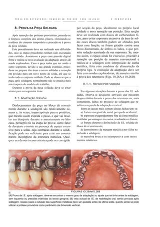 P R O V A   D O S   R E T E N T O R E S ,   R E M O Ç Ã O   EM   P O S I Ç Ã O   P A R A   S O L D A C E    E   R E M O N T A C E M



     8. P ROVA DA P EÇA S OLDADA                                                  por secção da peça, idealmente no próprio local
                                                                                  soldado e nova remoção em posição. Esta secção
    Após remoção das próteses provisórias, procede-se                             deve ser realizada com discos de carborundum fi-
à limpeza completa dos dentes pilares, eliminando-se                              nos, para evitar espessura excessiva da área de sol-
resíduos do cimento temporário e procede-se à prova                               da; esses discos também podem ser afinados para
da peça soldada.                                                                  fazer essa função, se forem girados contra uma
    Este procedimento deve ser realizado sem dificulda-                           broca diamantada, de ambos os lados, o que per-
des, caso as etapas precedentes tenham sido executadas                            mite redução acentuada da sua espessura. Se, mes-
com cuidado. Assenta-se a peça com pressão digital                                mo assim, o espaço ainda for excessivo, proceder à
firme e realiza-se nova avaliação da adaptação através de                         remoção em posição da maneira convencional e
sonda exploradora. Caso a peça tenha que ser unida a                              realiza-se a soldagem com interposição de cunha
outro segmento, devido à sua grande extensão, proce-                              metálica, feita com condutos de alimentação da
de-se ao preparo das áreas a serem soldadas e remoção                             própria liga. A avaliação da adaptação deve ser
em posição para um novo ponto de solda, até que se                                feita com sondas exploradoras, de maneira similar
tenha todo o conjunto soldado. Pode se observar que a                             à prova dos retentores (Figs. 10.26A e 10.26B).
peça, após soldagem, normalmente não se encaixa mais
nos troqueis do modelo de trabalho.                                                      8 . 1 . 1 . REPARO POR FUNDIÇÃO
    Durante a prova da peça soldada deve-se estar
atento para os seguintes itens:                                                       Em algumas situações durante a prova das I.E. sol-
                                                                                  dadas, observa-se desajustes cervicais que passaram
     8.1. ADAPTAÇÃO CERVICAL                                                      despercebidos durante a prova dos retentores ou, mais
                                                                                  comumente, falhas no processo de soldagem que re-
    Deslocamentos da peça no bloco de revesti-                                    sultam em perda da adaptação cervical.
mento durante a soldagem são relativamente co-                                        Entre as causas mais comuns dessas falhas tem-se:
muns e, às vezes, imperceptíveis para o protético,                                    a) fratura marginal do metal por queda acidental;
que mesmo assim executa o passo, o que vai resul-                                     b) espessura exageradamente fina da cinta metálica
tar em desajuste durante o assentamento ou bás-                                   vestibular por usinagem excessiva, resultando em fratura;
cula, perceptíveis na etapa de prova; outro fator                                     c) fratura durante a desinclusão da I.E. soldada do
de desajuste consiste na presença de espaço exces-                                bloco de revestimento;
sivo para a solda, cuja contração durante a solidi-                                   d) derretimento da margem metálica por falha na
ficação pode ser suficiente para criar um assenta-                                inclusão e soldagem;
mento incompleto da estrutura metálica. Qual-                                         e) manobra brusca ou intempestiva com instru
quer ura desses inconvenientes pode ser corrigido                                 mentos rotatórios.




                                                                           FIGURAS IO.26AelO.26B
(A) Prova de I.E. após soldagem, deve-se encontrar o mesmo grau de adaptação ou ajuste que se tinha antes da soldagem,
sem isquemia ou pressões indevidas do tecido gengival; (B) vista oclusal de I.E. de reabilitação oral, sendo provada após
soldagem; nesses casos a oclusão das superfícies metálicas deve ser ajustada antes da última solda, quando ainda se pode
utilizar a prótese provisória como parâmetro da dimensão vertical.
 