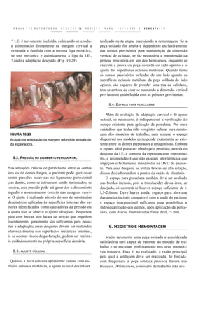 P R O V A   D O S   R E T E N T O R E S ,   R E M O Ç Ã O   EM   P O S I Ç Ã O      P A R A   S O L D A C EM   E   R E M O N T A C E M



  ^ I.E. é novamente incluída, colocando-se condu-                                  realizado nesta etapa, precedendo a remontagem. Se a
  e alimentação diretamente na margem cervical a                                    peça soldada for ampla e dependente exclusivamente
  reparada e fundida com a mesma liga metálica,                                     das coroas provisórias para manutenção da dimensão
  se une mecânica e quimicamente à liga da I.E.,                                    vertical de oclusão, se faz necessária a manutenção da
  ?,endo a adaptação desejada. (Fig. 10.29)                                         prótese provisória em um dos hemi-arcos, enquanto se
                                                                                    executa a prova da peça soldada do lado oposto e o
                                                                                    ajuste das superfícies oclusais metálicas. Quando tanto
                                                                                    as coroas provisórias ocluídas de um lado quanto as
                                                                                    superfícies oclusais metálicas da peça soldada do lado
                                                                                    oposto, são capazes de prender uma tira de celofane,
                                                                                    tem-se certeza de estar se mantendo a dimensão vertical
                                                                                    previamente estabelecida com as próteses provisórias.

                                                                                          8.4. ESPAÇO PARA PORCELANA


                                                                                        Além da avaliação da adaptação cervical e do ajuste
                                                                                    oclusal, se necessário, é indispensável a verificação do
                                                                                    espaço existente para aplicação da porcelana. Por mais
                                                                                    cuidadoso que tenha sido o registro oclusal para monta-
 IGURA 10.29                                                                        gem dos modelos de trabalho, nem sempre o espaço
 ificação da adaptação da margem refundida através de                               disponível nos modelos corresponde exatamente ao exis-
 da exploradora.                                                                    tente entre os dentes preparados e antagonistas. Embora
                                                                                    o espaço ideal possa ser obtido pelo protético, através do
                                                                                    desgaste da I.E. e controle da espessura com espessíme-
   8.2. PRESSÃO NO LIGAMENTO PERIODONTAL                                            tro, é recomendável que não existam interferências que
                                                                                    impeçam o fechamento mandibular na DVO do pacien-
Nas situações críticas de paralelismo entre os dentes                               te. Para esse desgaste se utiliza brocas de alta rotação,
ires ou de dentes longos, o paciente pode queixar-se                                discos de carborundum e pontas de óxido de alumínio.
sentir pressões indevidas no ligamento periodontal                                      O espaço para porcelana também deve ser avaliado
;ses dentes, como se estivessem sendo tracionados; se                               nas bordas incisais, pois a translucidez dessa área, se
:essiva, essa pressão pode até gerar dor e desconforto                              desejada, só ocorrerá se houver espaço suficiente de ±
mpedir o assentamento correto das margens cervi-                                    l,5-2,0mm. Deve haver ainda, espaço para abertura
s. O ajuste é realizado através do uso de substâncias                               das ameias incisais compatível com a idade do paciente
denciadoras aplicadas às superfícies internas dos re-                               e espaço interproximal suficiente para possibilitar a
itores identificados como causadores da pressão ou                                  individualização dos dentes, após aplicação da porce-
s quais não se obteve o ajuste desejado. Pequenos                                   lana, com discos diamantados finos de 0,25 mm.
yios com brocas, nos locais de atrição que impedem
issentamento, geralmente são suficientes para possi-
itar a adaptação; esses desgastes devem ser realizados                                    9. REGISTRO E REMOINTACEM
sferencialmente nas superfícies metálicas internas,
is se ocorrer riscos de perfuração, podem ser realiza-                                  Muito raramente uma peça soldada e considerada
is cuidadosamente na própria superfície dentária.                                   satisfatória será capaz de retornar ao modelo de tra-
                                                                                    balho e se encaixar perfeitamente nos seus respecti-
   8.5. AJUSTE OCLUSAL                                                              vos troqueis. Essa é, na realidade, a razão principal
                                                                                    pela qual a soldagem deve ser realizada. Se forçada,
  Quando a peça soldada apresentar coroas com su-                                   com frequência a peça soldada provoca fratura dos
rfícies oclusais metálicas, o ajuste oclusal deverá ser                             troqueis. Além disso, o modelo de trabalho não dis-
 