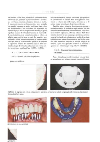 PRÓTESE   F I X A



ses detalhes. Além disso, esses locais constituem áreas           utilizar moldeira de estoque e silicona, que pode ser
retentivas que garantem o posicionamento e a remo-                de condensação ou adição. Para essas próteses reco-
ção correta da estrutura soldada no interior do molde.            menda-se silicona de condensação, deixando-se as de
É importante manter-se firmemente a peça soldada                  adição para a remontagem de próteses extensas.
em posição, enquanto se aplica o alginato, para evitar                Também após a obtenção do registro se procede à
seu deslocamento. Caso o alginato não seja capaz de               moldagem através da técnica da dupla mistura. Os dois
remover a peça, pois se rasga durante a remoção, pode             materiais são manipulados simultaneamente, colocando-
significar excesso de retenção friccionai da peça fundi-          se na moldeira o pesado e, sobre ele, o fluido. Parte desse
da ou discrepâncias de paralelismo entre os pilares. A            material deve ser levado aos espaços proximais, contorno
solução pode envolver uma ou mais das seguintes pos-              gengival e rebordo sob pônticos com auxílio de seringa,
sibilidades: alívio interno dos pontos de contato detec-          cuidando-se em manter firmemente no seu local a estru-
tados por solução evidenciadora; aplicação de vaselina            tura a ser remontada, enquanto se procede à injeção do
às superfícies internas dos retentores e/ou do dente pre-         material. Após essa aplicação assenta-se a moldeira e
parado; criação de retenções adicionais com resina acrí-          aguarda-se a polimerização (Figs. 10.34A e 10.34B).
lica na estrutura metálica (Figs. 10.33A e 10.33B).
                                                                            9 . 2 . 5 . COM ELASTÔMERO E MOLDEIRA
     9 . 2 . 2 . C OM   S I L I C O N A E MOLDEIRA DE                       INDIVIDUAL


     ESTOQUE Mesmo         em casos de próteses                       Para a obtenção de modelo remontado por esta técni-
                                                                  ca, aconselhável para próteses extensas, com envolvimento
   pequenas, pode-se




(A) Molde de alginato com I.E. de prótese com 4 retentores e I elemento isolado em posição; (B) molde de alginato com
I.E. dos dois hemi-arcos.




  FIGURAS I0.34A e I0.34B




  FIGURA
 