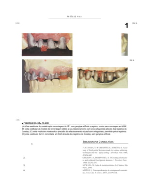 PRÓTESE FIXA




                                                                                                                                    1
0.43A                                                                                                                                           FIG. 10




                                                                                                                                            FIG. 10




).43C

        ■ FIGURAS IO.43Aa 10.43D
        (A) Vista vestibular do modelo após remontagem da I.E., com gengiva artificial e registro, pronto para montagem em ASA;
        (B) vista vestibular do modelo de remontagem obtido e seu relacionamento com arco antagonista através dos registros de
        Duralay; (C) vista vestibular mostrando a precisão do relacionamento oclusal com antagonista, permitido pelos registros;
        (D) vista vestibular de I.E. remontada em ASA através dos registros de Duralay, sem gengiva artificial.



                                                                             BIBLIOGRAFIA CONSULTADA
                  5.
                                                                             FUSAYAMA, T; WAKUMOTO, S.; HOSODA, H. Accu-
                                                                             racy of fixed partial dentures made by various soldering
                                                                             techniques and one - piece casting. /. Prosthet. Dent. 1964;
                                                                             42:434-442.
         2.                                                                  GEGAUFF, A., ROSENSTIEL, S. The seating of one-pie-
                                                                             ce and soldered fixed partial dentures. /. Prosthet. Dent.
                                                                             1989; 62:292-297.
         3.                                                                  KUWATA, M. Adas de metalocerâmica. Ed. Santos, São
                                                                             Paulo, 1986.
         4.                                                                  MILLER, L. Framework design in ceramometal restorati-
                                                                             on. Dent. Clin. N. Amer., 1977; 21:699-716.
 