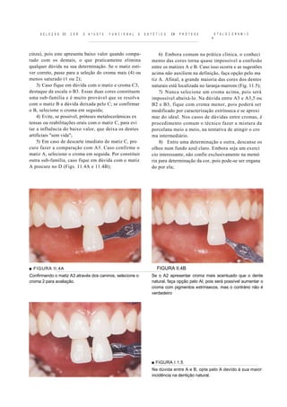 S E L E Ç Ã O   DE   C O R   E   A 1 U S T E   F U N C I O N A L   E   E S T É T I C O   EM   P R Ó T E S E       E T A L O C E R A M I C
                                                                                                                   A



cinza), pois este apresenta baixo valor quando compa-                                6) Embora comum na prática clínica, o conheci
rado com os demais, o que praticamente elimina                                   mento das cores torna quase impossível a confusão
qualquer dúvida na sua determinação. Se o matiz esti-                            entre os matizes A e B. Caso isso ocorra e as sugestões
ver correto, passe para a seleção do croma mais (4) ou                           acima não auxiliem na definição, faça opção pelo ma
menos saturado (1 ou 2);                                                         tiz A. Afinal, a grande maioria das cores dos dentes
    3) Caso fique em dúvida com o matiz e croma C3,                              naturais está localizada no laranja-marrom (Fig. 11.5);
destaque da escala o B3. Essas duas cores constituem                                 7) Nunca selecione um croma acima, pois será
uma sub-família e é muito provável que se resolva                                impossível abaixá-lo. Na dúvida entre A3 e A3,5 ou
com o matiz B a dúvida deixada pelo C; se confirmar                              B2 e B3, fique com croma menor, pois poderá ser
o B, selecione o croma em seguida;                                               modificado por caracterização extrínseca e se aproxi
    4) Evite, se possível, próteses metalocerâmicas ex                           mar do ideal. Nos casos de dúvidas entre cromas, é
tensas ou reabilitações orais com o matiz C, para evi                            procedimento comum o técnico fazer a mistura da
tar a influência do baixo valor, que deixa os dentes                             porcelana meio a meio, na tentativa de atingir o cro
artificiais "sem vida";                                                          ma intermediário.
    5) Em caso de descarte imediato do matiz C, pro                                  8) Entre uma determinação e outra, descanse os
cure fazer a comparação com A3. Caso confirme o                                  olhos num fundo azul claro. Embora seja um exercí
matiz A, selecione o croma em seguida. Por constituir                            cio interessante, não confie exclusivamente na memó
outra sub-família, caso fique em dúvida com o matiz                              ria para determinação da cor, pois pode-se ser engana
A procure no D (Figs. 11.4A e 11.4B);                                            do por ela;




■ FIGURA II.4A                                                                      FIGURA II.4B
Confirmando o matiz A3 através dos caninos, selecione o                          Se o A2 apresentar croma mais acentuado que o dente
croma 2 para avaliação.                                                          natural, faça opção pelo Al, pois será possível aumentar o
                                                                                 croma com pigmentos extrínsecos, mas o contrário não é
                                                                                 verdadeiro




                                                                                 ■ FIGURA I 1.5
                                                                                 Na dúvida entre A e B, opte pelo A devido à sua maior
                                                                                 incidência na dentição natural.
 