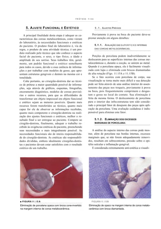 PRÓTESE   F I XA



     5. A JUSTE F UNCIONAL           E   E STÉTICO                   5 . 1 . AJUSTES PRÉVIOS


    A principal finalidade desta etapa é adequar as ca-        Previamente à prova na boca do paciente deve-se
racterísticas das coroas metalocerâmicas, como vieram       prestar atenção em alguns detalhes:
do laboratório, às necessidades funcionais e estéticas
do paciente. O produto final do laboratório é, via de                5.1.1.   AVALIAÇÃO DAS S U P E R F Í C I E S   INTERNAS

regra, o produto de uma atividade técnica; é um pro-                 DAS COROAS METALOCERÂMICAS .

duto realizado pelo técnico que não conhece o aspecto
facial do paciente, o sexo, o tipo físico, a idade e            Porções de porcelana podem inadvertidamente se
amplitude do seu sorriso. Seus trabalhos têm, geral-        deslocarem para as superfícies internas das coroas me-
mente, um padrão funcional e estético semelhante            talocerâmicas e, durante a cocção, se unirem ao metal.
para todos os casos, devido a essa carência de informa-     Quando é a porcelana opaca, ela é facilmente visuali-
ções e por trabalhar com modelos de gesso, que apre-        zada com lupa e eliminada com brocas diamantadas
sentam estruturas gengivais e dentais na mesma cor e        de alta rotação (Figs. 11.15A e 11.15B).
tonalidade.                                                     Se o fato ocorreu com porcelana de corpo, sua
    Cabe portanto, ao cirurgião-dentista dar ao técni-      visualização se torna muito mais difícil e sua detecção
co de prótese a maior quantidade possível de informa-       pode ser feita através de uma análise interior do assen-
ções, seja através de gráficos, esquemas, fotografias,      tamento das peças nos troqueis, previamente à prova
enceramento diagnóstico, modelos de coroas provisó-         na boca, pois frequentemente comprimem e desgas-
rias e outros recursos, para que as dificuldades de         tam o gesso no local do contato. Sua eliminação é
transformar um objeto impessoal em objeto funcional         feita da mesma forma. O deslocamento de porcelana
e estético sejam as menores possíveis. Quanto mais          para o interior das infra-estruturas tem sido conside-
recursos forem transferidos ao técnico, quanto mais         rado o principal fator de desajuste das peças após apli-
capaz for ele de observar as informações recebidas,         cação da porcelana. Uma avaliação cuidadosa é indis-
quanto mais competente o cirurgião-dentista na reali-       pensável para eliminar este fator.
zação dos ajustes funcionais e estéticos, melhor o re-
sultado final a ser entregue ao paciente. Compete ao                 5.1.2. ELIMINAÇÃO DOS EXCESSOS
cirugião-dentista, finalmente, adequar o trabalho re-                MARGINAIS DE PORCELANA:
cebido às exigências estéticas do paciente, preenchendo
suas necessidades o mais integralmente possível. As             A análise do aspecto interno das coroas pode mos-
necessidades funcionais são de inteira responsabilida-      trar, além de porcelana nas bordas internas, excessos
de do cirurgião-dentista. As estéticas são responsabili-    marginais que, se não forem adequadamente removi-
dades divididas, embora idealmente cirurgiões-dentis-       dos, resultam em sobrecontorno, pressão sobre o epi-
tas e pacientes devam estar satisfeitos com o resultado     télio sulcular e inflamação gengival.
estético de um trabalho.                                        E considerada extremamente anti-estética a visuali-




■ FIGURA I I . I 5 A                                            FIGURA I I . I 5 B
Eliminação de porcelana opaca com broca cone-invertido      Eliminação de opaco na margem interna de coroa metalo-
na margem interna de coroa metalocerâmica.                  cerâmica com broca diamantada.
 