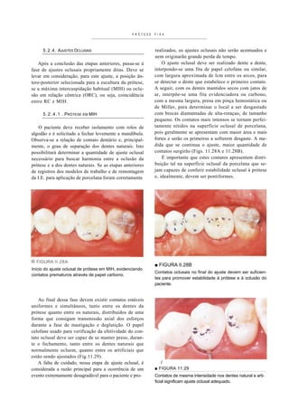 PRÓTESE   FIXA



     5.2.4. AJUSTES OCLUSAIS                                realizados, os ajustes oclusais não serão acentuados e
                                                            nem originarão grande perda de tempo.
   Após a conclusão das etapas anteriores, passa-se à           O ajuste oclusal deve ser realizado dente a dente,
fase de ajustes oclusais propriamente ditas. Deve se        interpondo-se uma fita de papel celofane ou similar,
levar em consideração, para este ajuste, a posição ân-      com largura aproximada de lcm entre os arcos, para
tero-posterior selecionada para a escultura da prótese,     se detectar o dente que estabelece o primeiro contato.
se a máxima intercuspidação habitual (MIH) ou oclu-         A seguir, com os dentes mantidos secos com jatos de
são em relação cêntrica (ORC), ou seja, coincidência        ar, interpõe-se uma fita evidenciadora ou carbono,
entre RC e MIH.                                             com a mesma largura, presa em pinça hemostática ou
                                                            de Miller, para determinar o local a ser desgastado
     5 . 2 . 4 . 1 . PRÓTESE EM MIH                         com brocas diamantadas de alta-rotaçao, de tamanho
                                                            pequeno. Os contatos mais intensos se tornam perfei-
    O paciente deve receber isolamento com rolos de         tamente nítidos na superfície oclusal de porcelana,
algodão e é solicitado a fechar levemente a mandíbula.      pois geralmente se apresentam com maior área e mais
Observa-se a relação de contato dentário e, principal-      fortes e serão os primeiros a sofrerem desgaste. A me-
mente, o grau de separação dos dentes naturais. Isto        dida que se continua o ajuste, maior quantidade de
possibilitará determinar a quantidade de ajuste oclusal     contatos surgirão (Figs. 11.28A e 11.28B).
necessário para buscar harmonia entre a oclusão da              É importante que estes contatos apresentem distri-
prótese e a dos dentes naturais. Se as etapas anteriores    buição tal na superfície oclusal da porcelana que se-
de registros dos modelos de trabalho e de remontagem        jam capazes de conferir estabilidade oclusal à prótese
da I.E. para aplicação de porcelana foram corretamente      e, idealmente, devem ser pontiformes.




  FIGURA II.28A
                                                            ■ FIGURA II.28B
Início do ajuste oclusal de prótese em MIH, evidenciando
                                                            Contatos oclusais no final do ajuste devem ser suficien-
contatos prematuros através de papel carbono.
                                                            tes para promover estabilidade à prótese e à oclusão do
                                                            paciente.


    Ao final dessa fase devem existir contatos estáveis
uniformes e simultâneos, tanto entre os dentes da
prótese quanto entre os naturais, distribuídos de uma
forma que consigam transmissão axial dos esforços
durante a fase de mastigação e deglutição. O papel
celofane usado para verificação da efetividade do con-
tato oclusal deve ser capaz de se manter preso, duran-
te o fechamento, tanto entre os dentes naturais que
normalmente ocluem, quanto entre os artificiais que
estão sendo ajustados (Fig.11.29).
    A falta de cuidado, nessa etapa de ajuste oclusal, é       /
considerada a razão principal para a ocorrência de um       ■ FIGURA 11.29
evento extremamente desagradável para o paciente e pro-     Contatos de mesma intensidade nos dentes natural e arti-
                                                            ficial significam ajuste oclusal adequado.
 