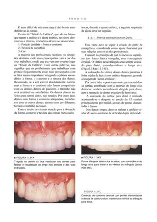 PRÓTESE   F I XA



    O mais difícil de toda essa etapa é dar formas mais       micas, durante o ajuste estético, a seguinte sequência
definitivas às coroas.                                        de ajuste deve ser seguida:
    Dentro da "Tríade da Estética", que são os fatores
que regem a análise e o ajuste estético, nas fases labo-               5 . 5 . 1 . VÉRTICE DOS INCISIVOS PARA DISTAL
ratoriais e clínicas, três tópicos devem ser observados:
    1) Posição dentária - forma e contorno                        Essa etapa deve se seguir à criação do perfil de
    2) Textura de superfície                                  emergência, considerada como ajuste funcional por
    3) Cor                                                    suas relações com os tecidos periodontais.
    A maioria dos profissionais, técnicos ou cirurgi-             Consiste no princípio de que os incisivos superio-
ões dentistas, estão mais preocupados com a cor dos           res tem forma básica triangular, com convergência
seus trabalhos, sendo que ela vem em terceiro lugar           cervical. O vértice desse triângulo está sempre coloca-
na "Tríade da Estética". Com outras palavras, isso            do para distal, considerando-se o longo eixo
significa que os profissionais que trabalham com              (Figs.ll.34Aa 11.34C).
prótese frequentemente estão mais preocupados com                 A colocação do vértice desses dentes paralelos à
o fator menos importante, relegando a planos secun-           linha média da face é erro estético frequente, gerando
dários a forma, o contorno e a textura dos dentes.            a imagem de "dente artificial".
Resumindo, se a cor estiver absolutamente correta,                Por outro lado, o posicionamento para mesial des-
mas a forma e o contorno não forem compatíveis                se vértice, combinado com a inversão do longo eixo
com os demais dentes do paciente, o trabalho não              dentário, também normalmente dirigido para distal,
será aceitável ou satisfatório. Os dentes devem ser           gera a sensação de dentes trocados de hemi-arco.
feitos para serem vistos, não notados. Por outro lado,             A colocação do vértice para distal é realizada
dentes com forma e contorno adequados, harmóni-               acentuando-se o desgaste na porção do 1/3 cervical
cos com os outros dentes, mesmo com cor diferente,            principalmente por mesial, através de pontas diaman-
tornam o trabalho aceitável.                                  tadas e discos.
    Com o intuito de chamar atenção para a obtenção                Nos dentes longos, deve se realizar o artifício co-
da forma, contorno e textura das coroas metalocerâ-           nhecido como contorno de deflexão dupla, utilizando




■ FIGURA I I . 3 4 A                                          ■ FIGURA II.34B
Traçado no centro da face vestibular dos dentes para          Forma triangular básica dos incisivos, com coincidência do
facilitar a visualização do longo eixo dentário e das suas    longo eixo para distal e do vértice do triângulo (ponto
inclinações.                                                  mais alto).




                                                                 FIGURA II.34C
                                                              Correçao do contorno cervical com pontas diamantadas
                                                              e discos de carborundum, mantendo o vértice do triângulo
                                                              para distal.
 