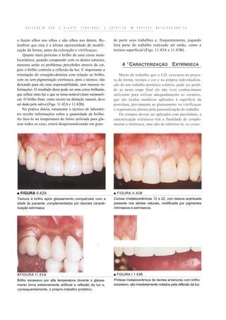 S E L E Ç Ã O   DE   C O R   E   A J U S T E   F U N C I O N A L   E   E S T É T I C O   EM   P R Ó T E S E   M E T A L O C E R Â M I C A



o fazem olhos nos olhos e não olhos nos dentes. Re-                             de parte seus trabalhos e, frequentemente, jogando
lembrar que esta é a última oportunidade de modifi-                             fora parte do trabalho realizado até então, como a
cação da forma, antes da coloração e vitrificaçao.                              textura superficial (Figs. 11.43A e 11.43B).
    Quanto mais próximo o brilho de uma coroa meta-
locerâmica, quando comparado com os dentes naturais,
menores serão os problemas percebidos através da cor,                                   4 ' CARACTERIZAÇÃO EXTRÍNSECA
pois o brilho controla a reflexão da luz. E importante a
orientação do cirurgião-dentista com relação ao brilho,                             Muito do trabalho que o CD. executou na procu-
com ou sem pigmentação extrínseca, para o técnico, não                          ra da forma, textura e cor e na própria individualiza-
deixando para ele essa responsabilidade, sem maiores in-                        ção de um trabalho protético estético, pode ser perdi-
formações. O resultado disso pode ser uma coroa brilhante,                      do se nesta etapa final ele não tiver conhecimento
que reflete mais luz e que se torna notável (mais metaméri-                     suficiente para utilizar adequadamente os corantes,
ca). O brilho final, como ocorre na dentição natural, deve                      que são óxidos metálicos aplicados à superfície da
ser dado pela saliva (Figs. 11.42A e 11.42B).                                   porcelana, previamente ao glazeamento ou vitrificaçao
    Na prática diária, raramente o técnico de laborató-                         e responsáveis diretos pela personalização do trabalho.
rio recebe informações sobre a quantidade de brilho.                                Os corantes devem ser aplicados com parcimônia; a
Ao faze-lo na temperatura do forno utilizada para gla-                          caracterização extrínseca tem a finalidade de comple-
zear todos os caso, estará despersonalizando em gran-                           mentar a intrínseca, mas não de substituí-la; os coran-




■ FIGURA II.42A                                                                 ■ FIGURA II.42B
Textura e brilho após glazeamento compatíveis com a                              Coroas rmetalocerâmicas 12 e 22, com textura acentuada
idade do paciente, complementados por discreta caracte-                          presente nos dentes naturais, modificada por pigmentos
rização extrínseca                                                               intrínsecos e extrínsecos.




                                                                   ,




AFIGURA I I . 4 3 A                                                             ■ FIGURA I 1.43B
Brilho excessivo por alta temperatura durante o glazea-                          Prótese metalocerâmica de dentes anteriores com brilho
mento torna extremamente artificial a reflexão da luz e,                         excessivo, são imediatamente notados pela reflexão da luz.
consequentemente, o próprio trabalho protético.
 