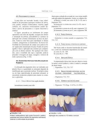 PRÓTESE   FIXA



         4.5. PROCEDIMENTO CLÍNICOS                              rência para a seleção da cor pode ter o seu croma modifi-
                                                                 cado pela adição dos pigmentos. Assim, se o objetivo for:
      A peça deve ser escovada, lavada e seca, elimi-               a) Manter o croma, nas cores A, B, C e D, usar o
   nando-se da porcelana quaisquer resíduos de saliva,           pigmento 703;
   cera, grafite, solução evidenciadora, vaselina, papel            b) Aumentar o croma nas cores A e D, usar o
   carbono, etc, materiais rotineiramente usados du-             pigmento 713
   rante a prova da porcelana e o ajuste funcional e                c) Aumentar o croma na cor B, usar o pigmento 712
   estético.                                                        d) Aumentar o croma na cor C, usar o pigmento 708
      A seguir, procede-se ao isolamento do campo
   operatório com rolos de algodão, secagem dos dentes                4 . 4 . 2 . TERÇO CERVICAL
   e instalação da prótese, procedendo-se à pintura ou
   aplicação dos corantes diretamente na boca do paci-               Aumentar o croma usando os pigmentos 712,
   ente. Toma-se como base para reprodução os dentes             713, 717.
   vizinhos, antagonistas ou homónimos. Se houver di-
   ficuldade de manutenção de campo seco pode-se fa-                  4 . 4 . 5 . T ERÇO   INCISAL E PONTAS DE CÚSPIDES

   zer opção pela manutenção da peça fixada em porta-
                                                                     São locais onde se encontra translucidez do esmal-
   agulha e fazer a aplicação dos corantes por compara-
                                                                 te e, como tal, totalmente dependentes da idade.
   ção com os dentes naturais. Por qualquer dos méto-
                                                                     a) cores A e D - 705
   dos, caso o resultado não seja o esperado, pode-se
                                                                     b) cores B e C - 708
   proceder à lavagem em água, secagem e reinicio de
   todo o processo (Fig. 11.46).
                                                                      4.4.4. DEFLEXÃO DUPLA
         4.4. SUGESTÕES PRÁTICAS PARA APLICAÇÃO DO                  A pigmentação dessa área tem por objetivo torná-
         PIGMENTO                                                la menos visível (reduzir o valor) e reduzir a sensação
                                                                 de dente longo.
       A colocação dos pigmentos deve ser realizada com             - Pigmentos: 713, 715, 717
   pincéis finos e a quantidade ou saturação depende da
   modificação que se pretende realizar. No próprio estojo            4.4.5. ÁREAS PRÓXIMO-CERVICAIS, SULCOS
   ou em lojas especializadas de porcelana artesanal, se              OCLUSAIS, CONCAVIDADE           PALATINA/LINCUAL
   encontram recipientes próprios para manter os coran-
   tes e a glicerina.                                                - Pigmentos 712, 713

         4 . 4 . 1 . T ERÇO M ÉDIO Esta região dentária               4.4.6. CÁRIES E SULCOS OCLUSAIS

       normalmente tomada como refe-                                - Pigmento: 715 (Figs. 11.47A a 11.47C)




■ FIGURA I 1.46                                              ■ FIGURA I 1.47A
Prótese metalocerâmica após ajuste funcional e estético,     Aplicação dos corantes no 1/3 médio e cervical
preparada para pintura através dos pigmentos extrínsecos;
observar a uniformidade da porcelana.
 