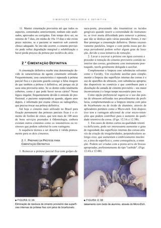 C I M E N T A Ç Ã O   P R O V I S Ó R I A   E   D E F I N I T I V A



    11. Manter cimentação provisória até que todos os                   saca-ponte, procurando não traumatizar os tecidos
aspectos, comentados anteriormente, tenham sido anali-                  gengivais quando inserir a extremidade do instrumen-
sados, aprovados ou corrigidos. Este tempo deve ser, no                 to; se tiver muita dificuldade para remover a prótese,
mínimo de 7 dias, em média de 10a 15 dias e não existe                  que não se desloca após várias pancadas firmes, é me-
prazo máximo, se o paciente se mantiver sob controle                    lhor postergar a cimentação definitiva. Dentes excessi-
clínico adequado. Se isto não ocorrer, o cimento provisó-               vamente paralelos, longos e com perda óssea por do-
rio pode sofrer degradação marginal e solubilização e                   ença periodontal podem sofrer algum grau de luxa-
haver perda precoce da prótese por recidiva de cárie.                   ção, devido a essa tentativa de remoção;
                                                                            2. Lavar e escovar a prótese em água corrente e
                                                                        proceder à remoção do cimento provisório contido no
      2 * C IMENTAÇÃO D EFINITIVA                                       interior das coroas, geralmente com instrumento pon-
                                                                        teagudo, tarefa geralmente delegada à auxiliar.
    A cimentação definitiva recebe essa denominação de-                     Complementar a limpeza com substâncias solventes
vido às características do agente cimentante utilizado.                 como o Cavidry. Um excelente auxiliar para comple-
Frequentemente, essa característica é repassada à prótese               mentar a limpeza das superfícies internas das coroas é o
parcial fixa e o paciente guarda consigo a falsa imagem                 uso de aparelhos de ultrasom, com substâncias apropria-
de que também a prótese é definitiva, até porque ele já                 das disponíveis no comércio e que contribuem para a
usou uma provisória antes. Se os dentes estão totalmente                dissolução da camada de cimento provisório - seu maior
cobertos, como é que pode haver novas cáries? Nessa                     inconveniente é o longo tempo necessário para isso.
lógica singular, frequentemente devido à omissão do pro-                    Como opção preferencial sugere-se o uso das pon-
fissional, o paciente surpreende-se quando, alguns anos                 tas de ultrasom utilizadas nos procedimentos de profi-
depois, é informado por exame clínico ou radiográfico,                  laxia, complementando-se a limpeza interna com jatos
que precisa trocar sua prótese definitiva.                              de bicarbonato ou de óxido de alumínio, através de
    Até hoje o cimento mais utilizado no Brasil para                    aplicadores portáteis como o Micro-etch. Este disposi-
fixação permanente das próteses parciais fixas é o ci-                  tivo tem a vantagem adicional de criar micro-reten-
mento de fosfato de zinco, que tem mais de 100 anos                     ções que podem contribuir para o aumento da quali-
de bons serviços prestados à Odontologia, embora                        dade retentiva da coroa. (Figs. 12.3A e 12.3B).
existam outros cimentos como os ionoméricos ou re-                          3. Em casos de dentes curtos ou qualidade retenti
sinosos que podem substituí-lo com vantagens.                           va deficiente, pode ser interessante aumentar o grau
    A sequência técnica a ser descrita é válida pratica-                de rugosidade das superfícies internas das coroas atra
mente para os dois cimentos.                                            vés da criação de irregularidades, perpendiculares ao
                                                                        longo eixo, que aumentam o embricamento mecâni
     2.1. PREPARO DA PRÓTESE PARA                                       co, a área de superfície e, como consequência, a reten
     CIMENTAÇÃO DEFINITIVA                                              ção. Podem ser criadas com a ponta ativa de brocas
                                                                        apropriadas, preferentemente do tipo "carbide". (Figs.
   1. Remover a prótese parcial fixa com golpes de                      12.4A e 12.4B)




■ FIGURA I2.3A                                                          ■ FIGURA I2.3B
Eliminação de resíduos de cimento provisório das superfí-               lateamento com óxido de alumínio, através do Micro-Etch.
cies internas da prótese fixa com jatos de bicarbonato.
 
