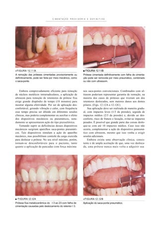C I M E N T A Ç Ã O   P R O V I S Ó R I A   E   D E F I N I T I V A




«FIGURA 12.1 IA                                                        ■ FIGURA 12.1 IB
A remoção das próteses cimentadas provisoriamente ou                   Prótese cimentada definitivamente com falha de cimenta-
definitivamente, pode ser feita por meio mecânico, como                ção pode ser removida por meio pneumático, combinado
o saca-ponte.                                                          ou não com ultrassom.



    Embora comprovadamente eficiente para remoção                      nos saca-pontes convencionais. Combinados com ul-
de núcleos metálicos intrarradiculares, a aplicação de                 trasom poderiam representar garantia de remoção, na
ultrasom para remoção de retentores de prótese fixa                    maioria dos casos de próteses que tiveram um dos
exige grande dispêndio de tempo (18 minutos) para                      retentores deslocados, sem maiores danos aos dentes
mostrar alguma efetividade. Por ser de aplicação des-                  pilares. (Figs. 12.12A a 12.12C)
confortável, gerando vibração e calor, com frequência                      Sua aplicação deve ser realizada de maneira gradu-
esse tempo precisa ser diluído em diferentes sessões                   al, com impactos leves (1/3 da pressão), seguida de
clínicas, mas poderia complementar ou auxiliar o efeito                impactos médios (2/3 da pressão) e, devido ao des-
dos dispositivos mecânicos ou pneumáticos, nota-                       conforto, risco de fratura e luxação, evitar-se impactos
damente se apresentarem ação do tipo piezoelétrica.                    pesados. É possível que grande parte das coroas deslo-
    Tentando suprir as deficiências desses dispositivos                que-se com até 10 impactos médios. Caso isso não
mecânicos surgiram aparelhos saca-pontes pneumáti-                     ocorra, complementar a ação do dispositivo peneumá-
cos. Tais dispositivos simulam a ação do aparelho                      tico com ultrasom, mesmo que isso venha a exigir
mecânico, mas possibilitam controle da carga exercida                  sessões adicionais.
para deslocar a prótese. No seu nível máximo, porém,                       Embora exista uma observação clínica, consis-
tornam-se desconfortáveis para o paciente, tanto                       tente e de ampla aceitação de que, uma vez desloca-
quanto a aplicação de pancadas com força máxima                        da, uma prótese nunca mais volta a adquirir sua




■ FIGURA I2.I2A                                                        «FIGURA I 2 . I 2 B
Prótese fixa metalocerâmica do I 3 ao 23 com falha de                  Aplicação do saca-ponte pneumático.
cimentação causadas pelo deslocamento do retentor I 3.
 