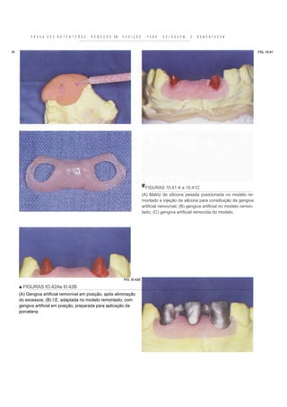 Livro Prótese fixa:  odontostation