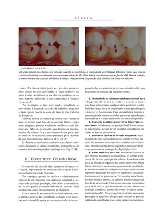 PRÓTESE   FIXA




  FIGURAS 2.1 A e 2.IB
(A) Vista lateral dos dentes em oclusão quando a mandíbula é manipulada em Relaç...