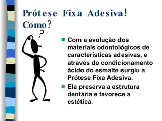 Prótese Fixa Adesiva! Como? ,[object Object],[object Object]