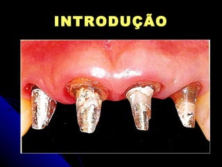 INTRODUÇÃO 