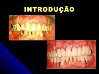INTRODUÇÃO 