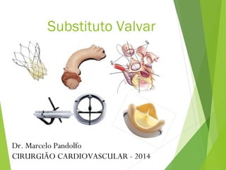 Substituto Valvar
Dr. Marcelo Pandolfo
CIRURGIÃO CARDIOVASCULAR - 2014
 