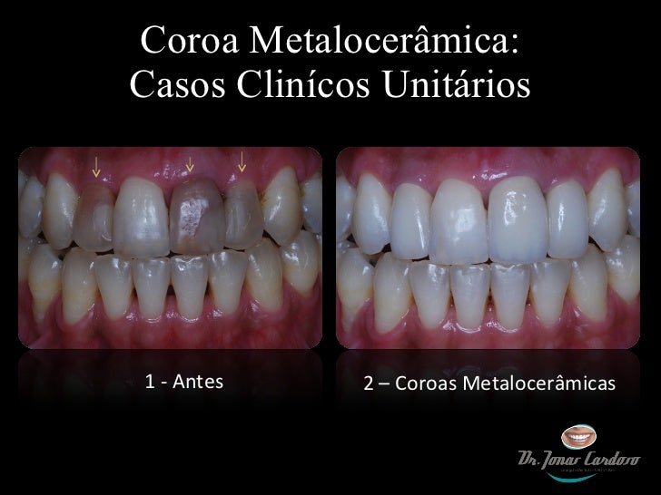 Phenotypic and Genotypic Diagnosis of