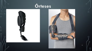 15
Órteses
 