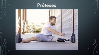3
Próteses
 