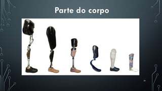 36
Parte do corpo
 